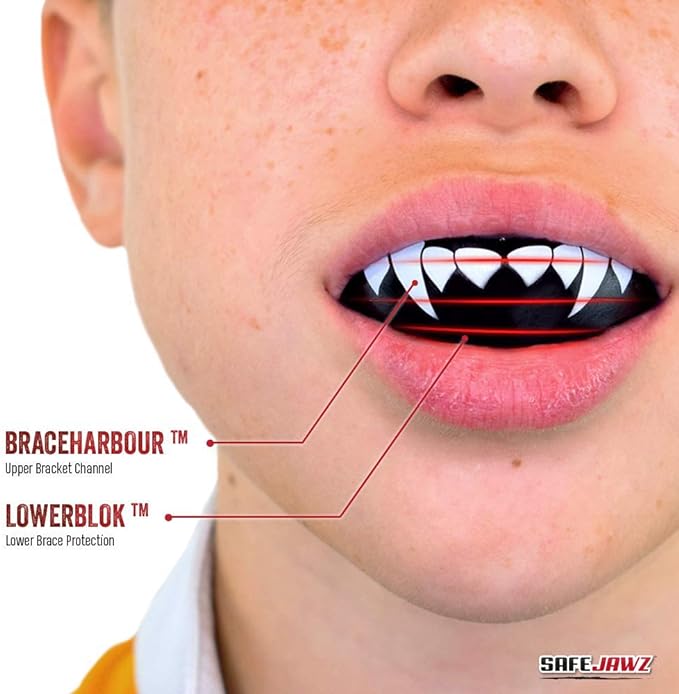 محافظ دندان SafeJawz
