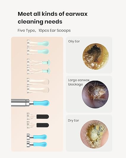 دستگاه پاک‌سازی گوش با دوربین ۱۰۸۰  BEBIRD R1